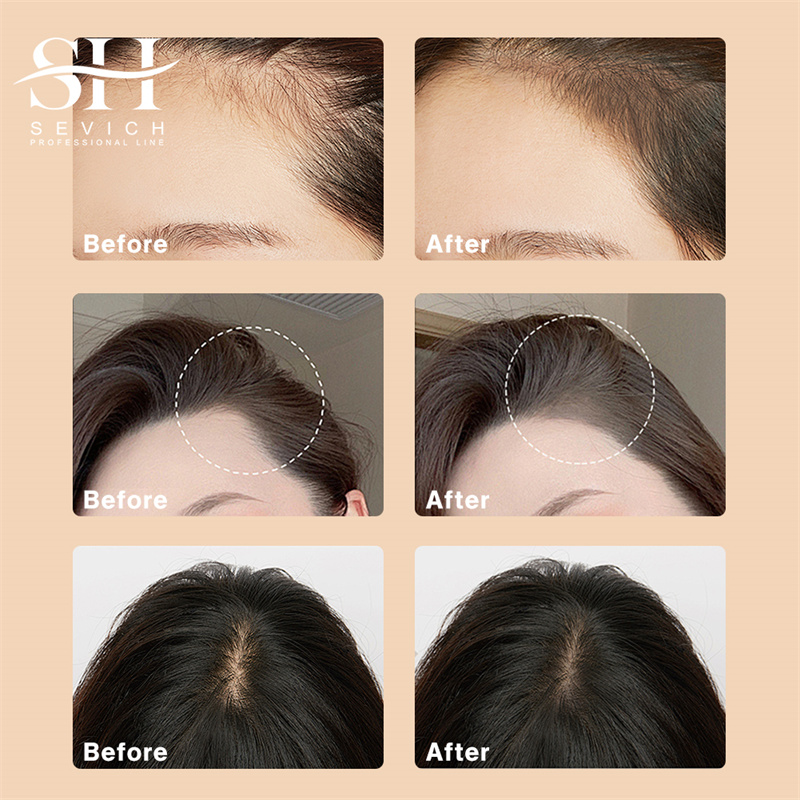 SEVICH 12g Hairline Powder Wit - огляд і ціна Rooting Hormone Powder